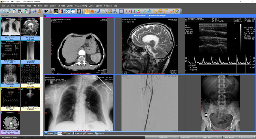 Sante DICOM Viewer Pro 14.2.4 CT医学影像查看工具